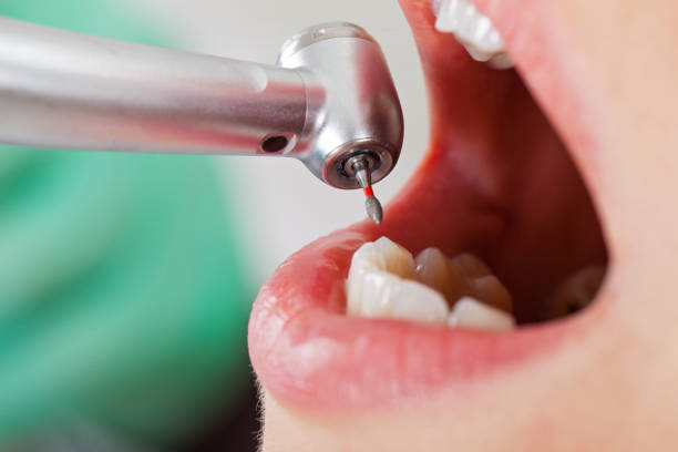 Best Pediatric Emergency Dentist in Boles Acres, NM